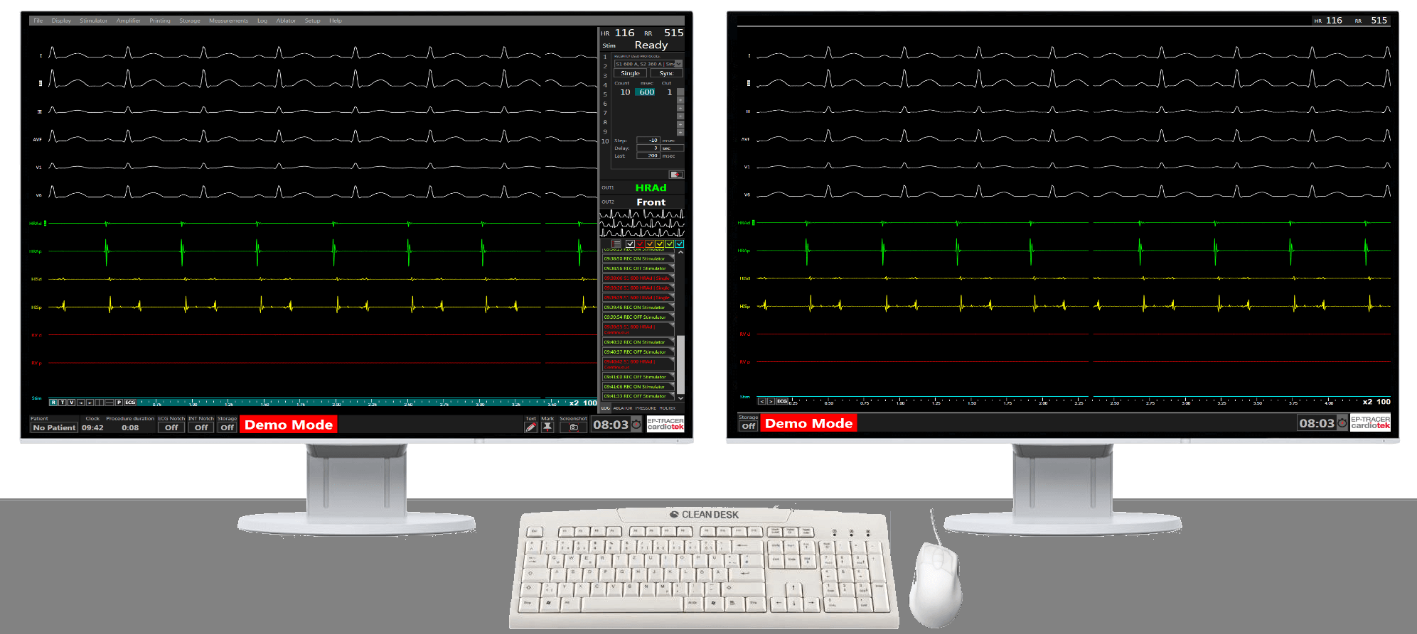 Electrophysiology Study